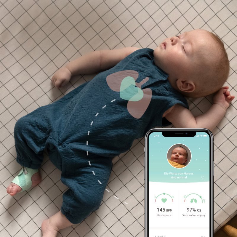 Owlet Smart Sock Plus Baby Monitor (0-5 years)